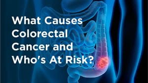 What Causes Colorectal Cancer and Who’s At Risk? | Health Hive