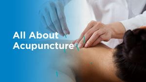 All about acupuncture and photo of man receiving acupuncture services.