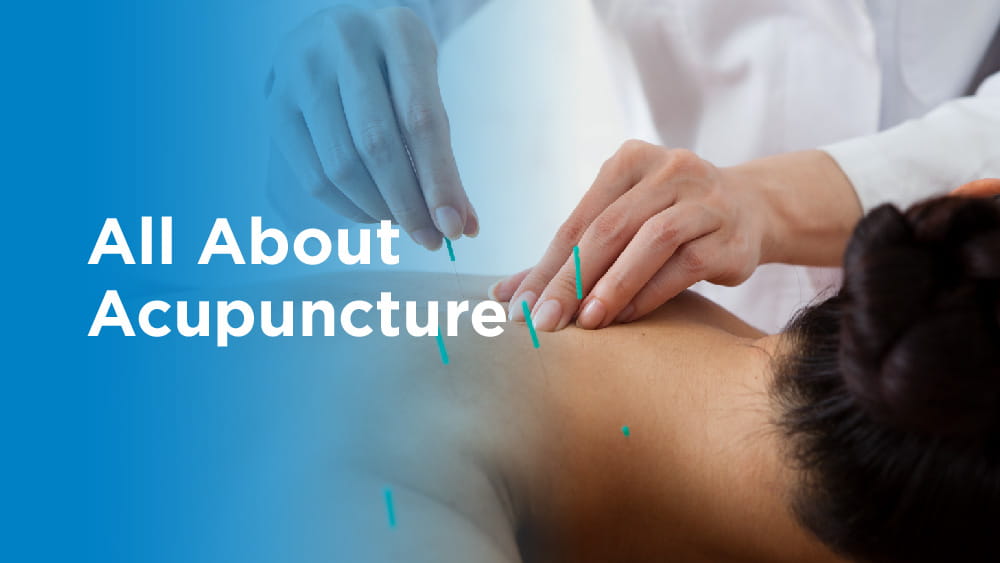 All About Acupuncture Health Hive