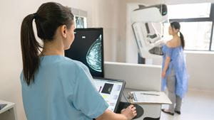 Unrecognizable nurse taking a mammogram exam to an adult patient at the hospital
